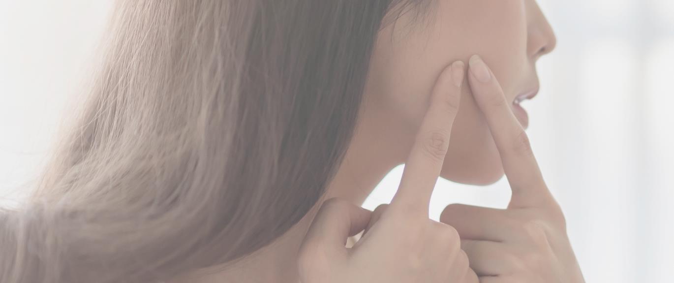 Is Acne Caused By What You&#39;re Eating?