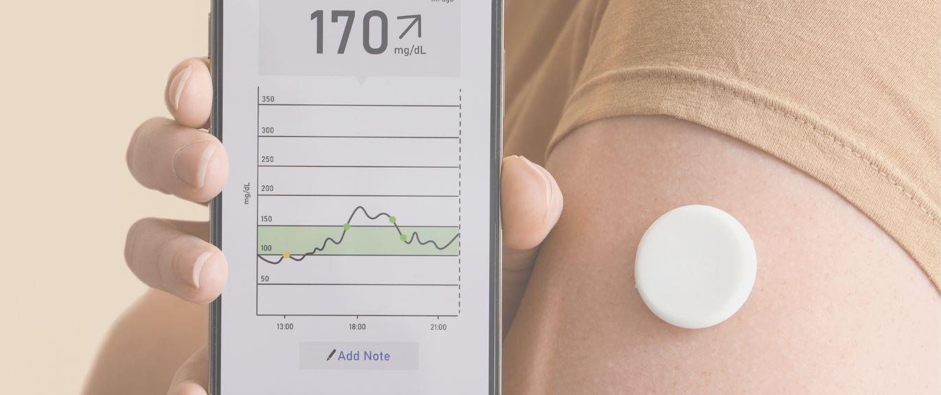 Should You Use a CGM?
